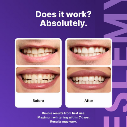 NESLEMY Purple Teeth Whitening Strips - 7/21 Whitening Sessions - Safe for Enamel - Non Sensitive Teeth Whitening - Peroxide-Free